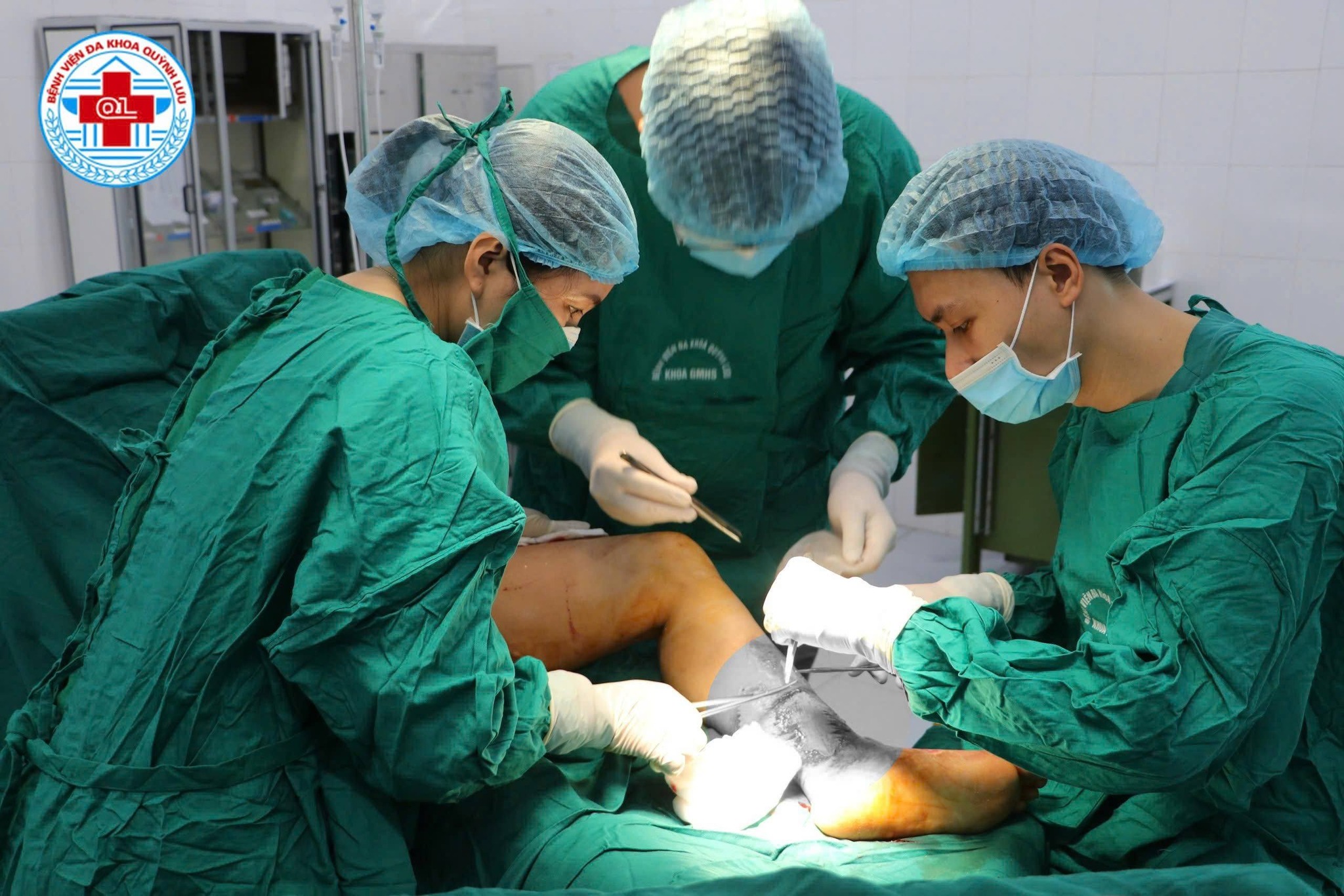 GHÉP DA ĐIỀU TRỊ KHUYẾT DA